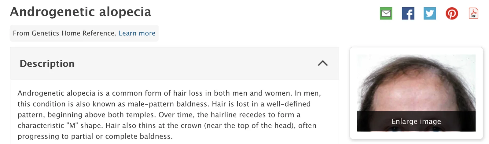 Alopecia