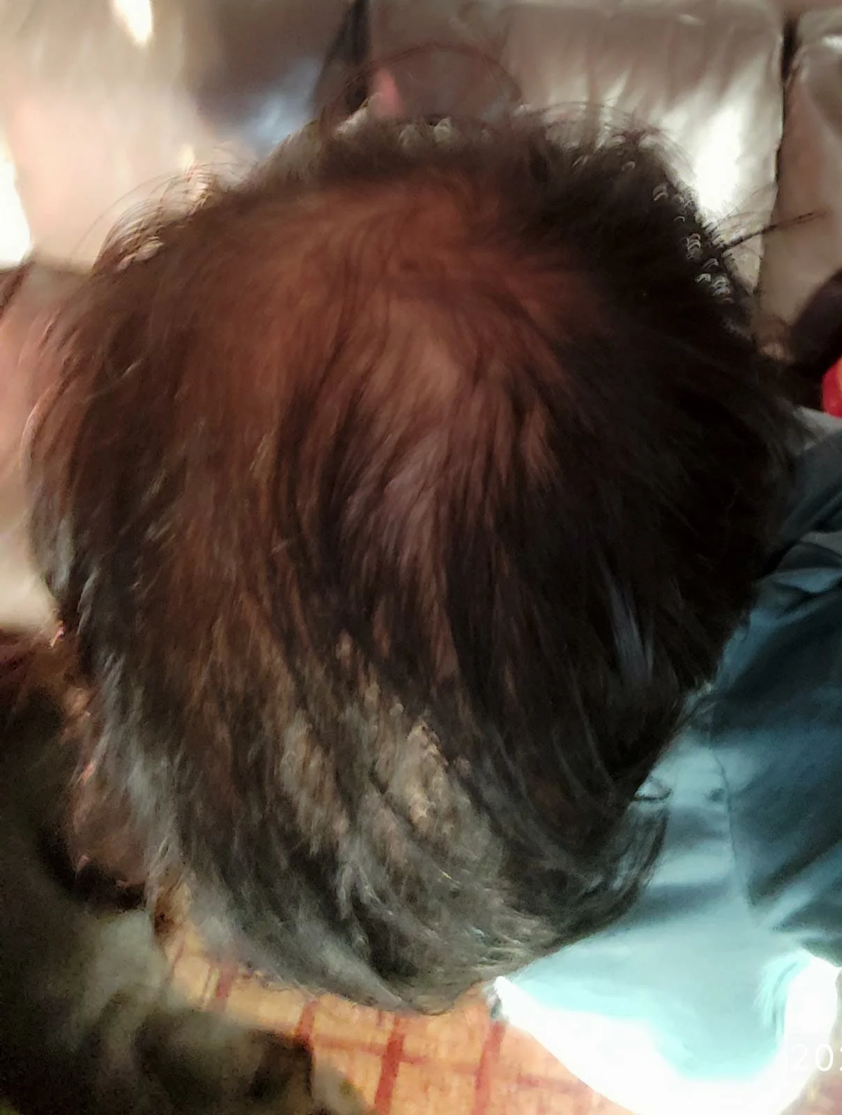 Bald Head