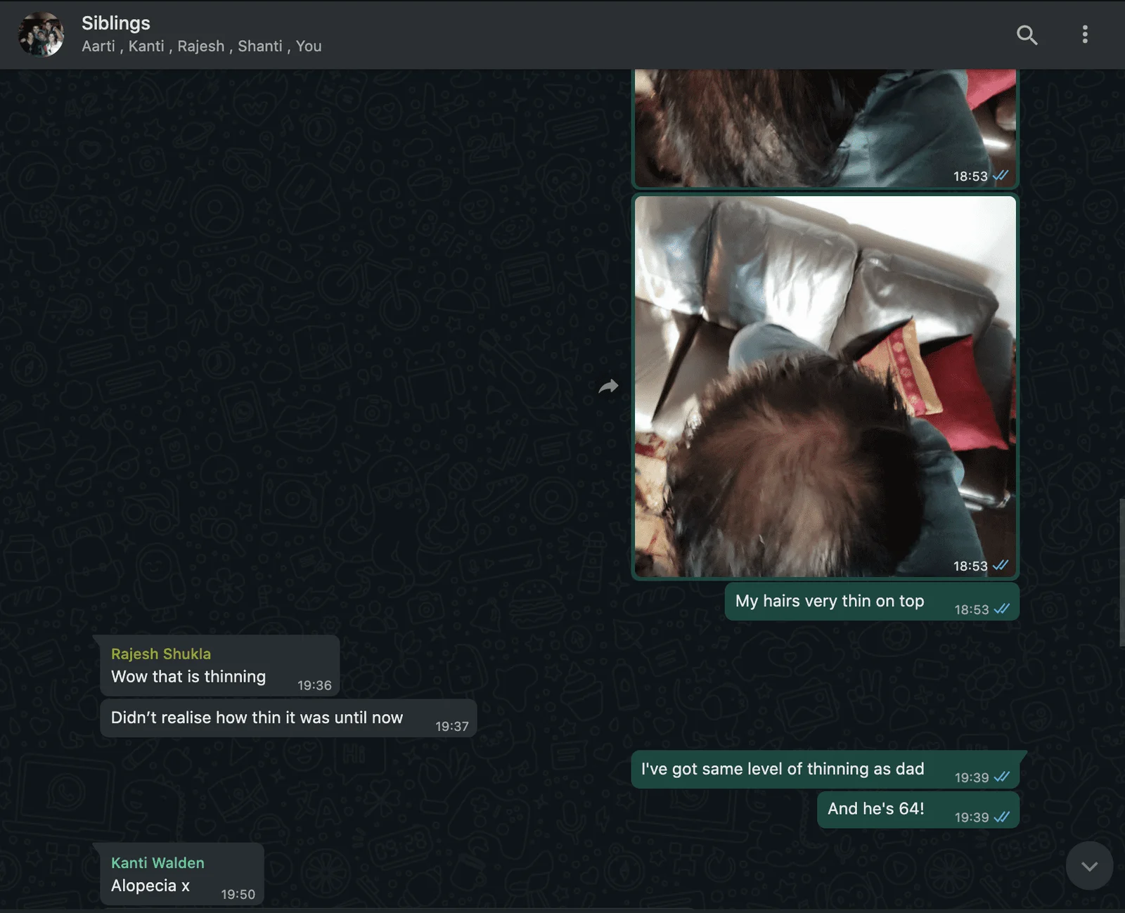 Hair Transplant