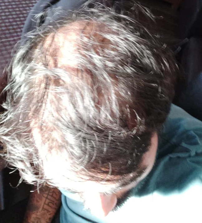 My hair