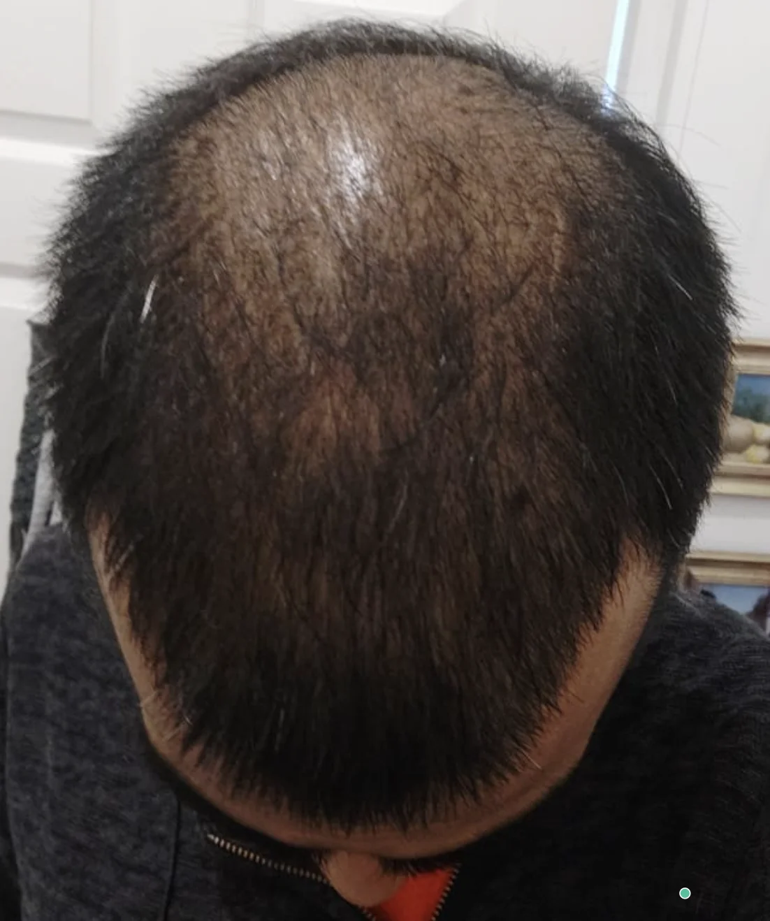My Hair