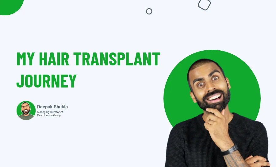 My Hair Transplant Journey