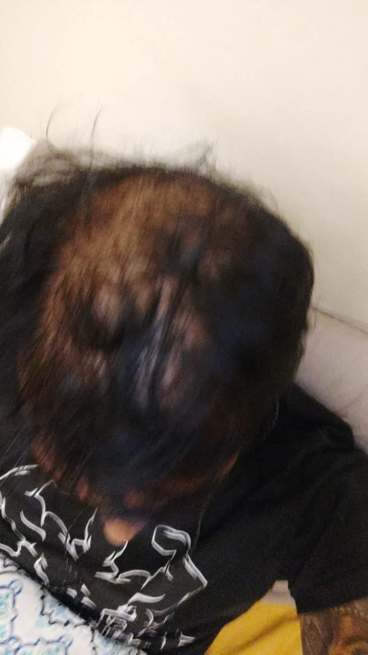 My Head View