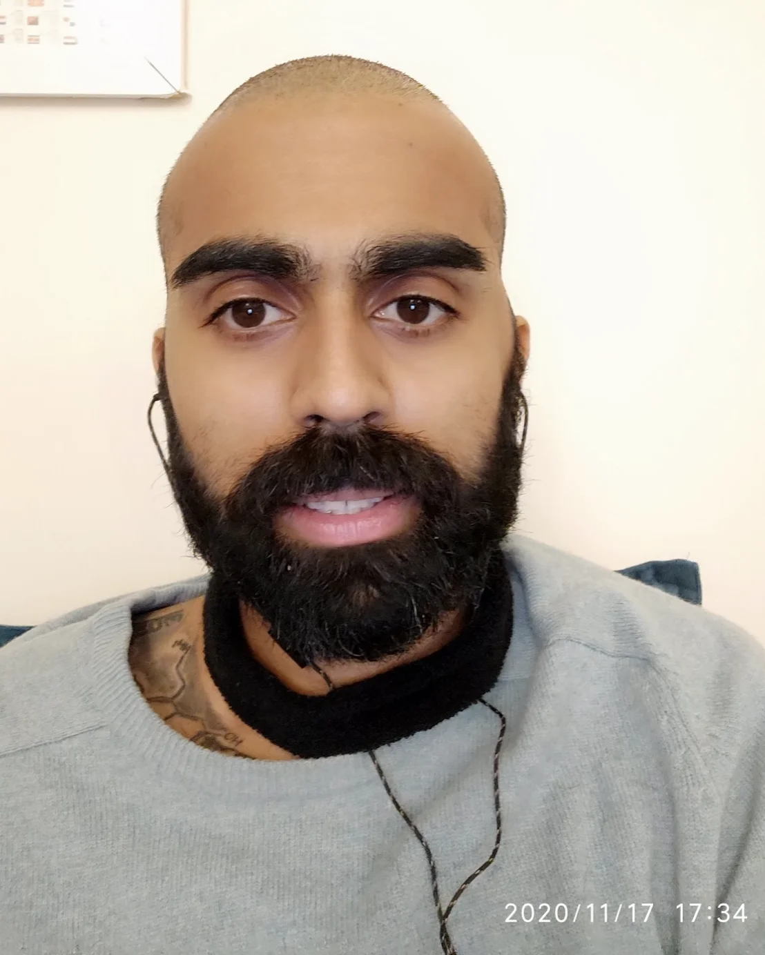 Scalp slowly