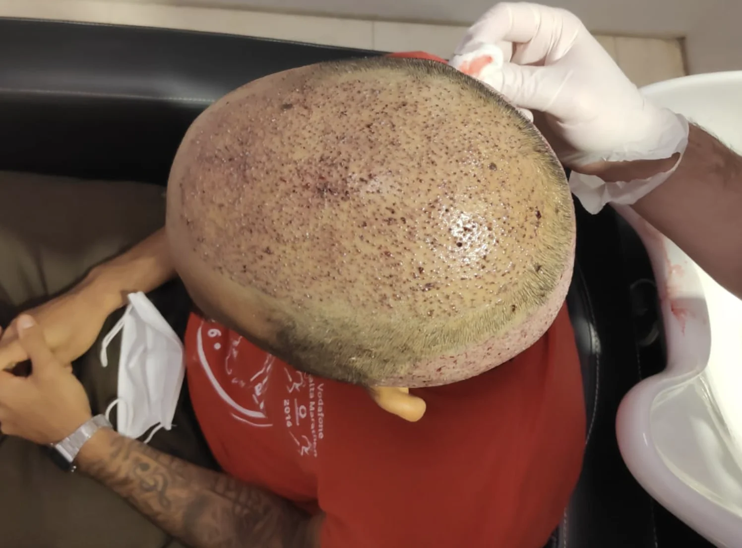 Squeamish