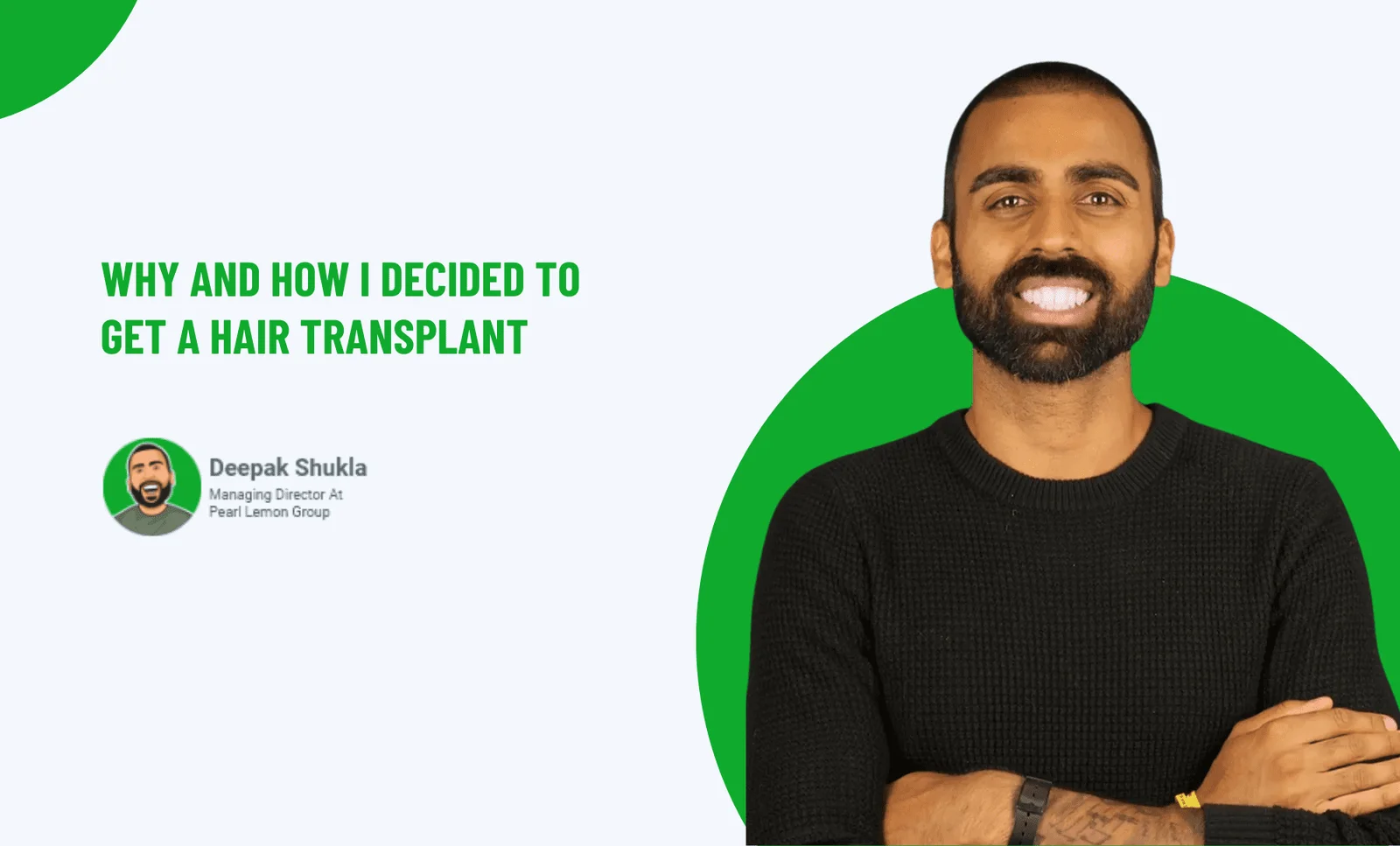 Why And How I Decided To Get A Hair Transplant